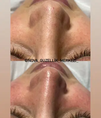 Nova Güzellik Merkezi